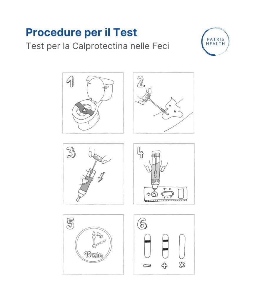 Illustrazione della procedura per il Test per la Calprotectina nelle Feci Patris Health®.