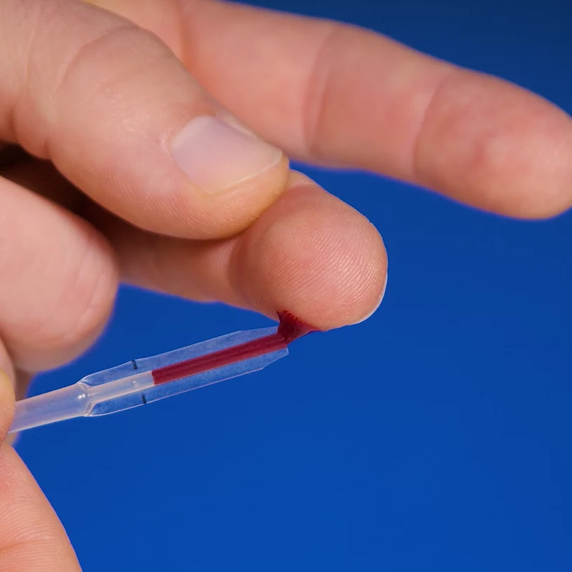 Prelievo del campione: una goccia di sangue dal polpastrello
