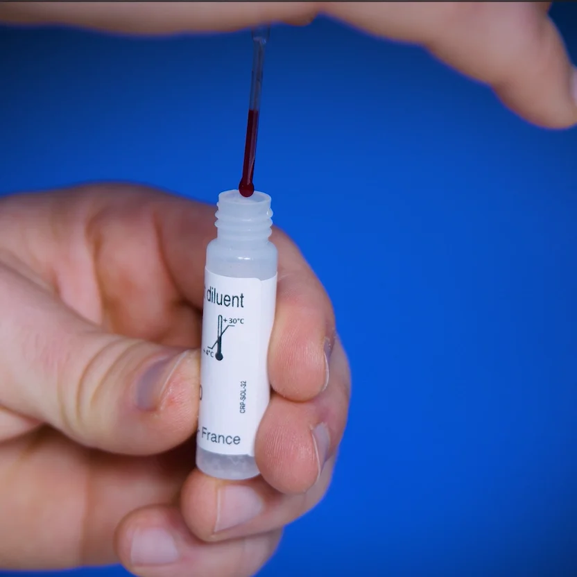 Test per la Proteina C-Reattiva di Patris Health – passaggio 3, trasferimento del sangue nel flacone contagocce con il diluente